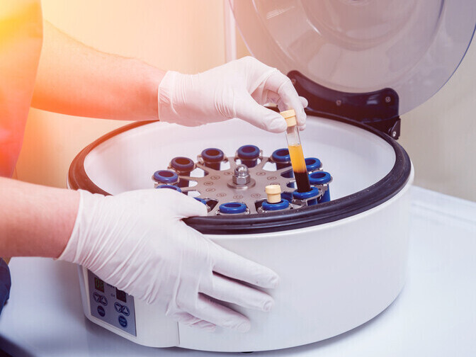 Plasma separation in the centrifuge